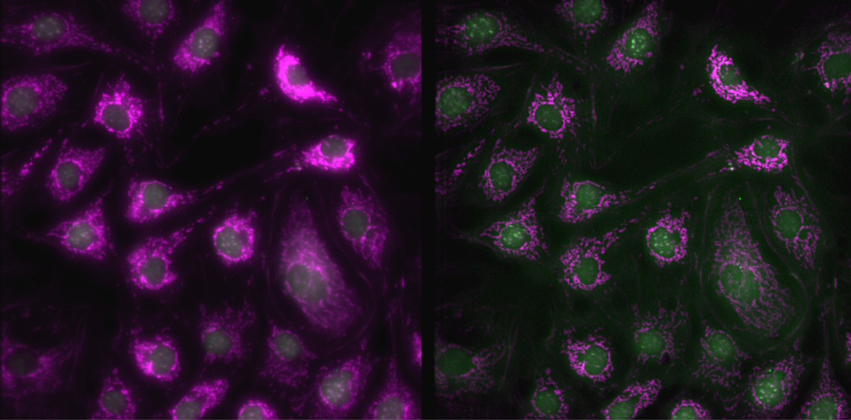 Fluorescence microscopy cell imaging processed with Arnas Scope deconvolution software by Arnas Technologies