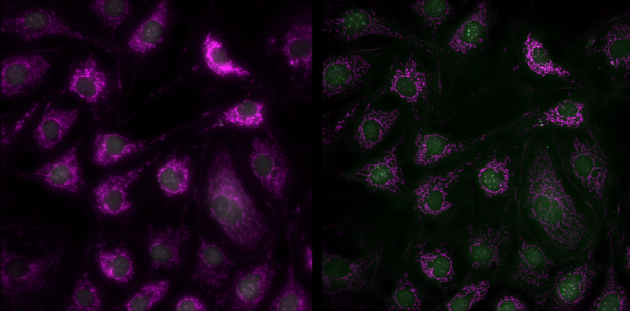 Fluorescence microscopy dual-channel image showing magenta and green fluorescent cell labeling — Arnas Scope deconvolution result